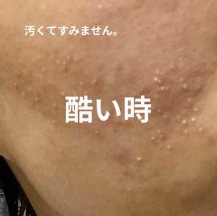 化粧水・敏感肌用・高保湿タイプ/無印良品/化粧水を使ったクチコミ(3枚目)