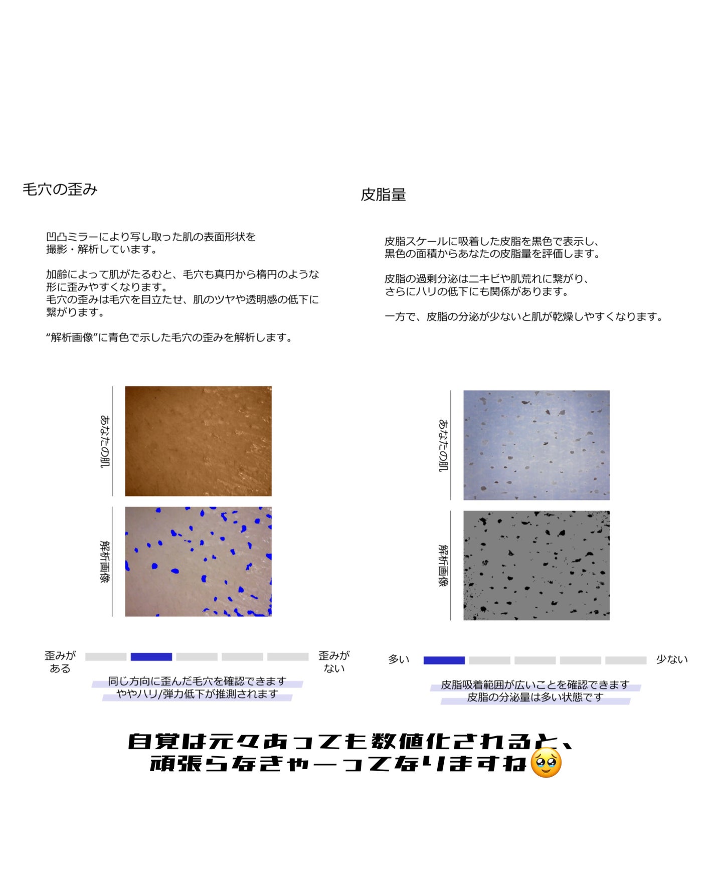 skin analysis kit(肌診断キット)/COCO.skin/その他スキンケアを使ったクチコミ(4枚目)