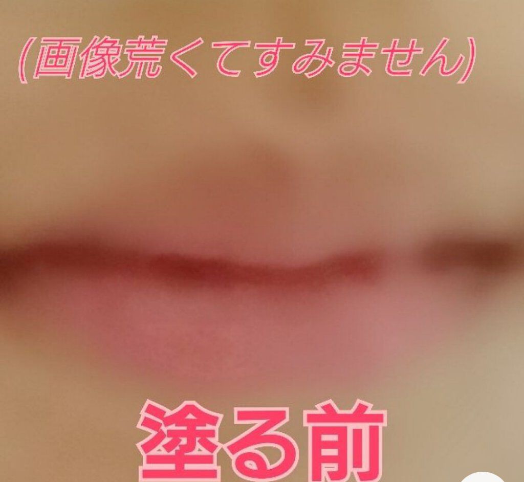 リップフォンデュ/メンソレータム/リップバームを使ったクチコミ(4枚目)