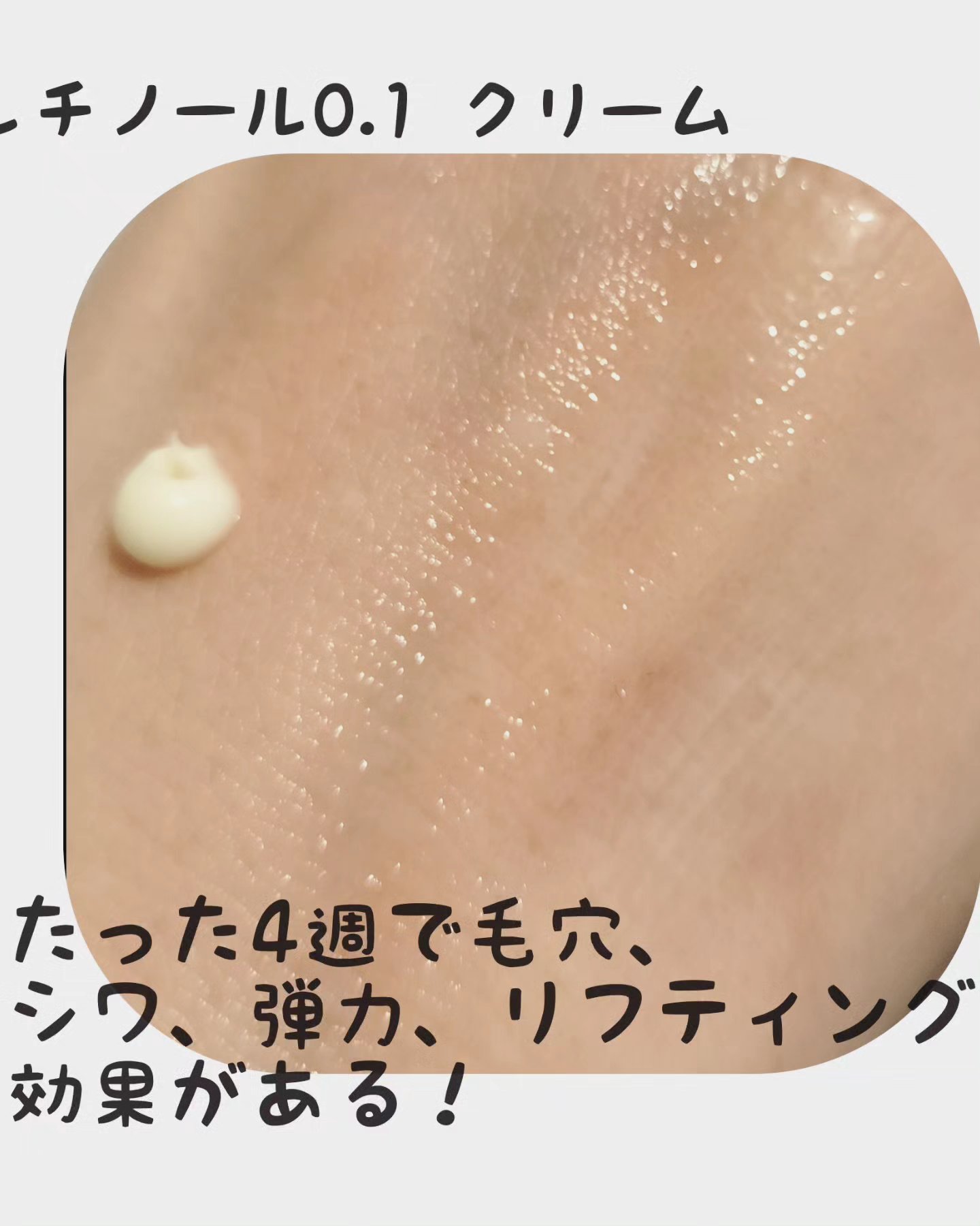 RXザ・レチノール0.1クリーム/COSRX/フェイスクリームを使ったクチコミ（3枚目）