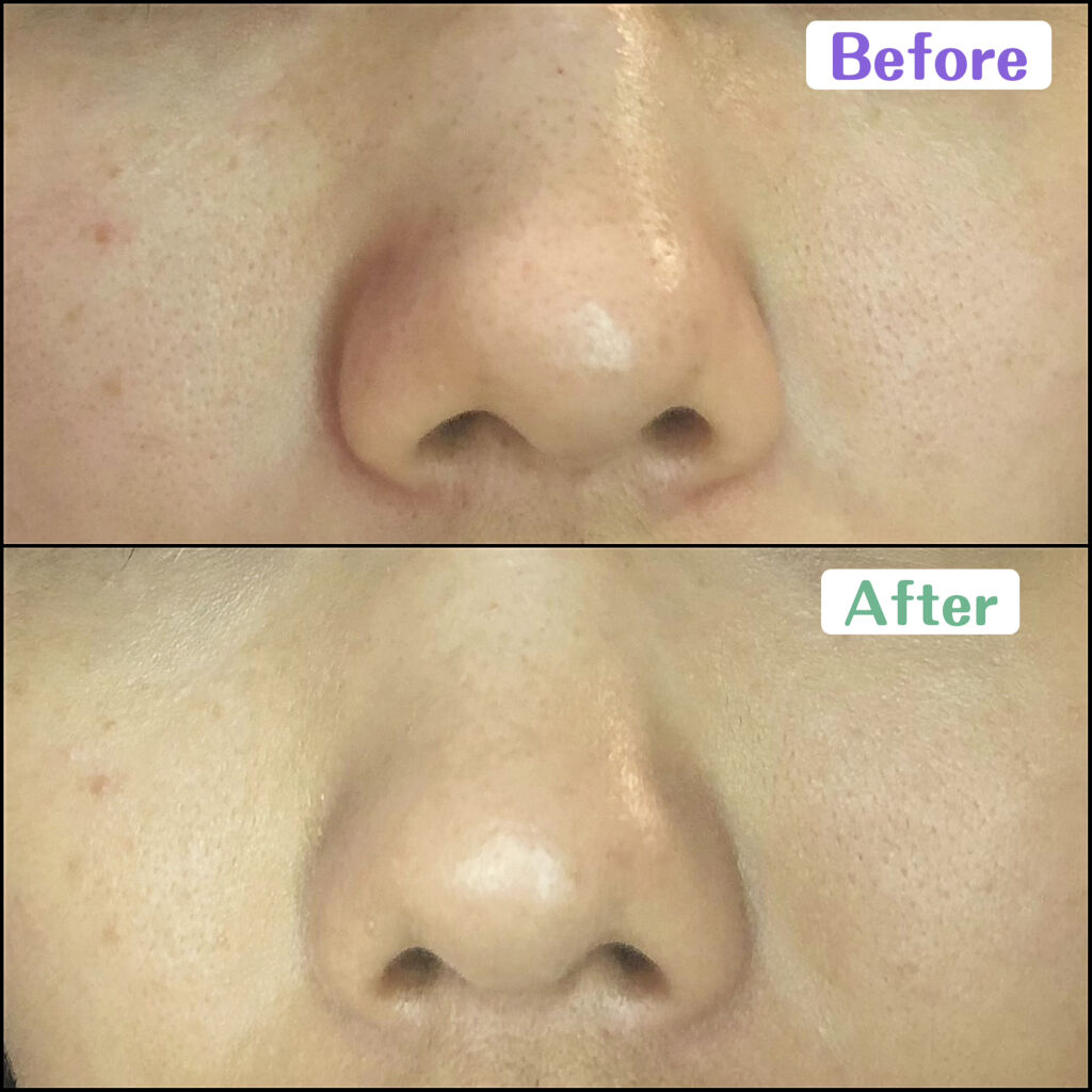 コンシーリング ベース 肌なじみのよいベージュ/Visée/化粧下地を使ったクチコミ（2枚目）