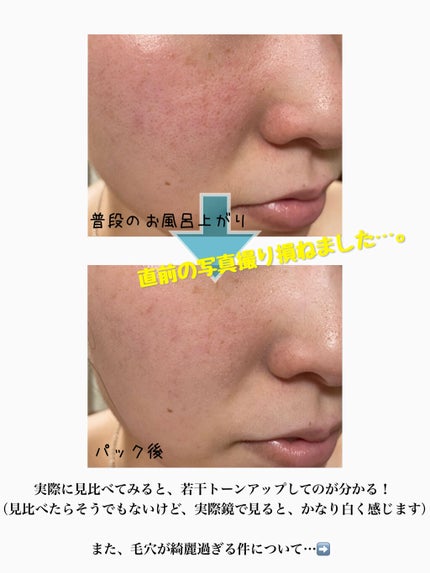 薬用ホワイトパックN/透明白肌/洗い流すパック・マスクを使ったクチコミ(3枚目)