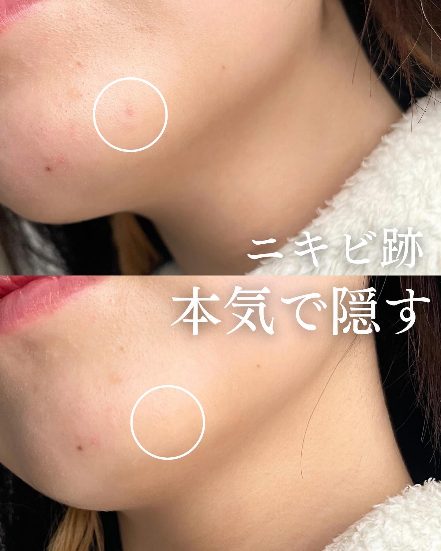 カバーパーフェクション トリプル ポット コンシーラー/the SAEM/パレットコンシーラーを使ったクチコミ（1枚目）