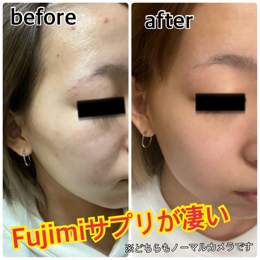 パーソナライズサプリメント「FUJIMI(フジミ)」/FUJIMI/健康サプリメントを使ったクチコミ(1枚目)