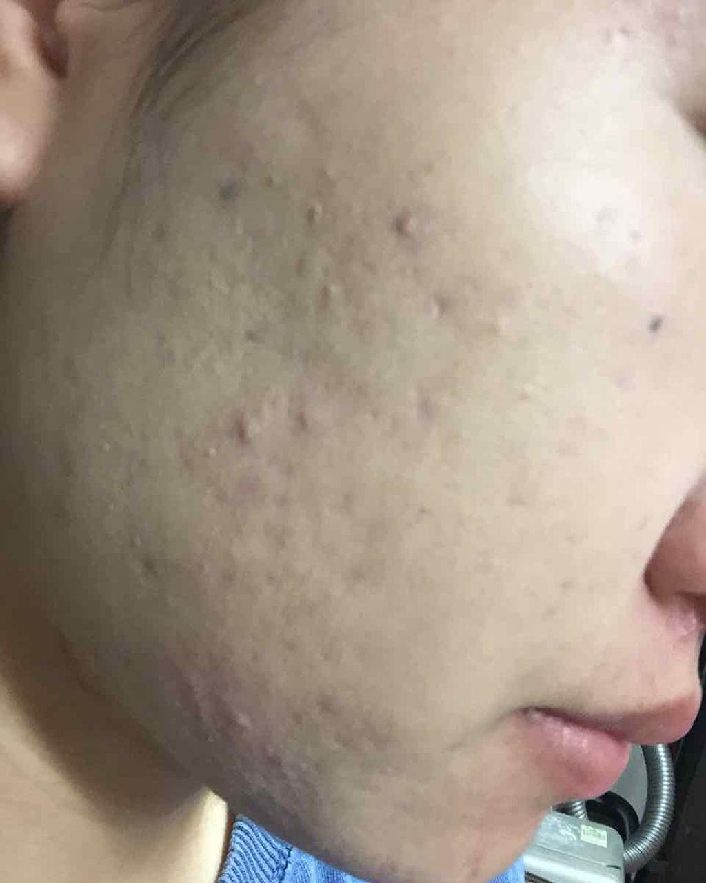 水ジェリークラッシュ/インテグレート/クリーム・エマルジョンファンデーションを使ったクチコミ（2枚目）