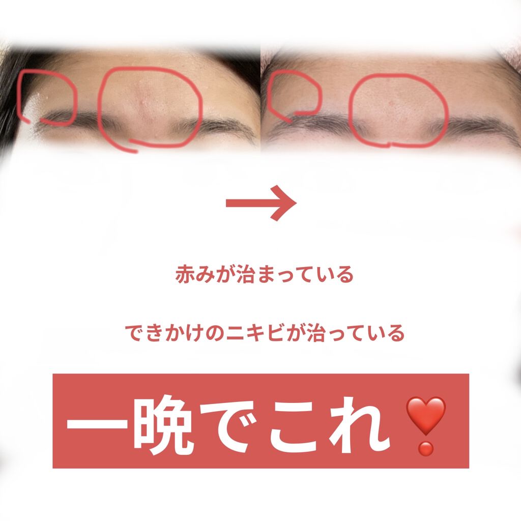 パンテノールシカブレミッシュクリーム/BIOHEAL BOH/フェイスクリームを使ったクチコミ（2枚目）