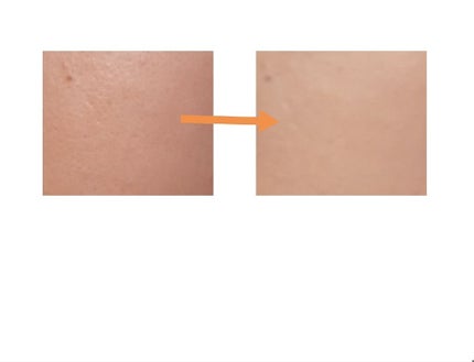 ウェアルーUV/HANAorganic/日焼け止めローションを使ったクチコミ(2枚目)