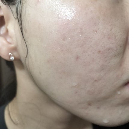 ハトムギ化粧水(ナチュリエ スキンコンディショナー R )/ナチュリエ/化粧水を使ったクチコミ(1枚目)