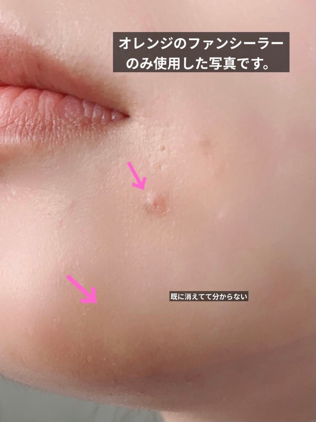 &be ファンシーラー/&be/パレットコンシーラーを使ったクチコミ(4枚目)
