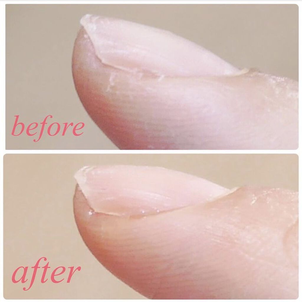 ロールオンアイクリーム/JMsolution/アイケア・アイクリームを使ったクチコミ（3枚目）