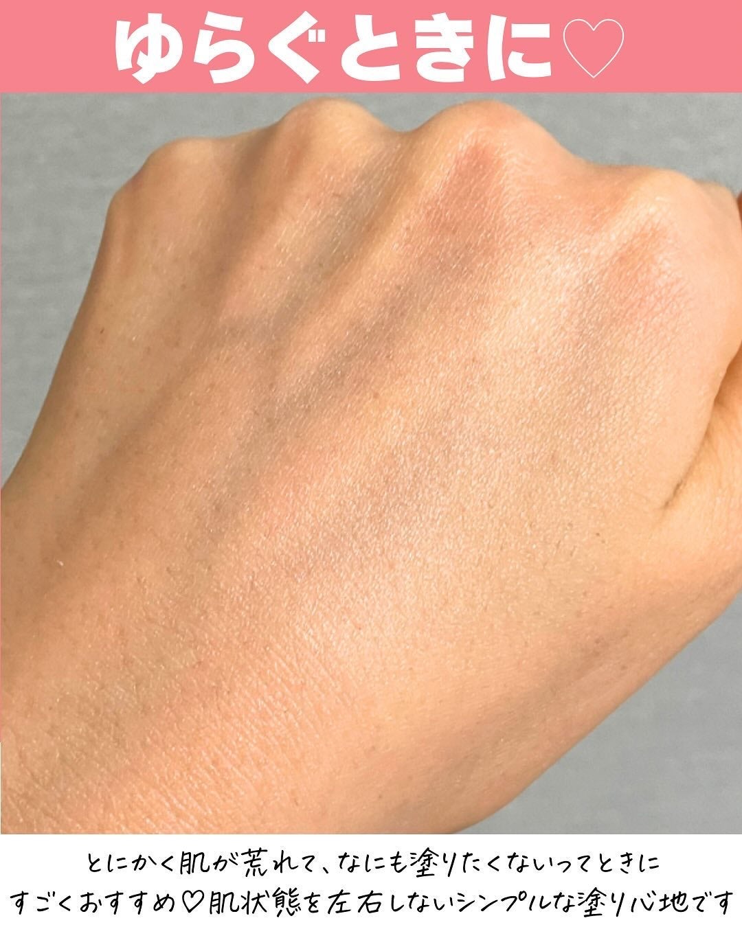 LASER REJUVENATION CREAM/Cell Fusion C(セルフュージョンシー)/フェイスクリームを使ったクチコミ(5枚目)