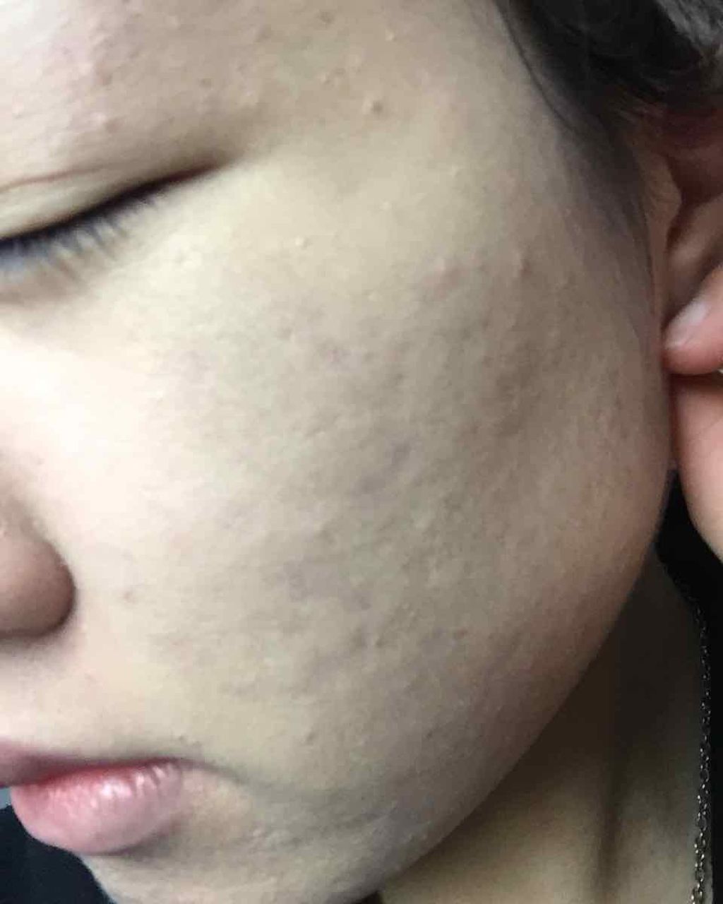 SP クッション ウルトラカバークッション BB/MAYBELLINE NEW YORK/クッションファンデーションを使ったクチコミ（2枚目）