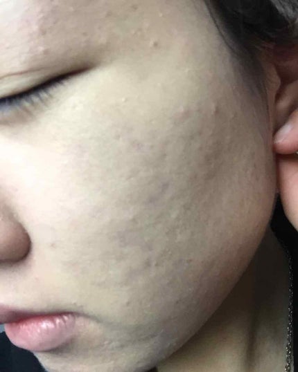 SP クッション ウルトラカバークッション BB/MAYBELLINE NEW YORK/クッションファンデーションを使ったクチコミ(2枚目)