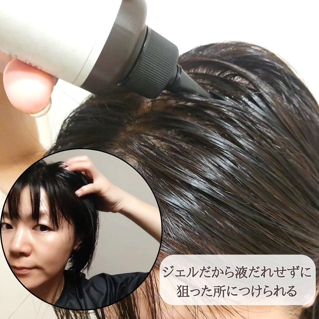 ナノグロウリッチ/iqumore/頭皮ローションを使ったクチコミ(4枚目)