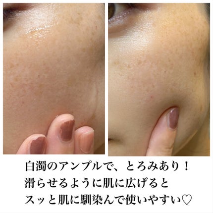 バクチオールAアンプル/23years old/美容液を使ったクチコミ(4枚目)