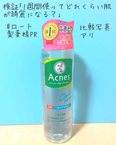 メンソレータム アクネス 薬用クリア化粧水のクチコミ「今回はLips様ロート製薬様から頂いたふき取り化粧水
のレビューになります！！🥳
※検証写真は.....」（1枚目）