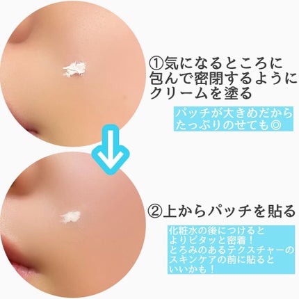 薬用ニキビケア スポッツクリーム/アクネスラボ/フェイスクリームを使ったクチコミ(4枚目)