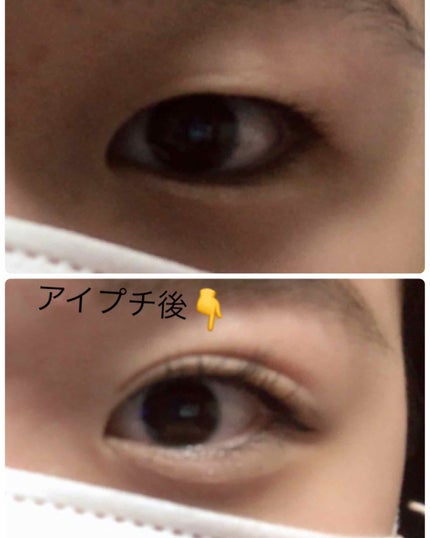 ハイブリッドフィルム/アイトーク/二重まぶた用アイテムを使ったクチコミ(2枚目)