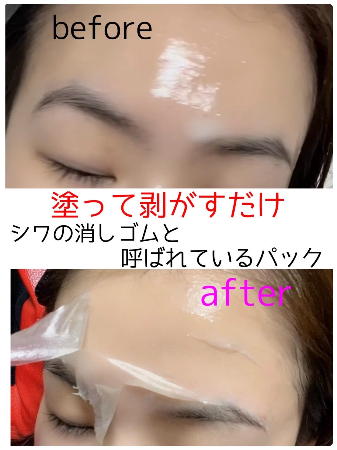 ピカピカ肌セット T1コラーゲン ドモルパック