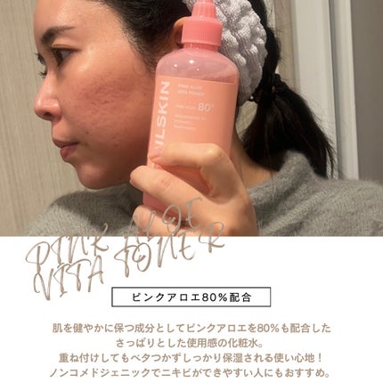 ピンクアロエビタトナー/APRILSKIN/化粧水を使ったクチコミ(3枚目)
