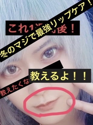 ダーマパワーX リップエッセンス/オバジ/リップ美容液を使ったクチコミ（1枚目）