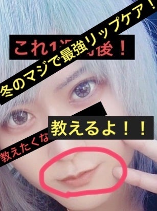 ダーマパワーX リップエッセンス/オバジ/リップ美容液を使ったクチコミ(1枚目)