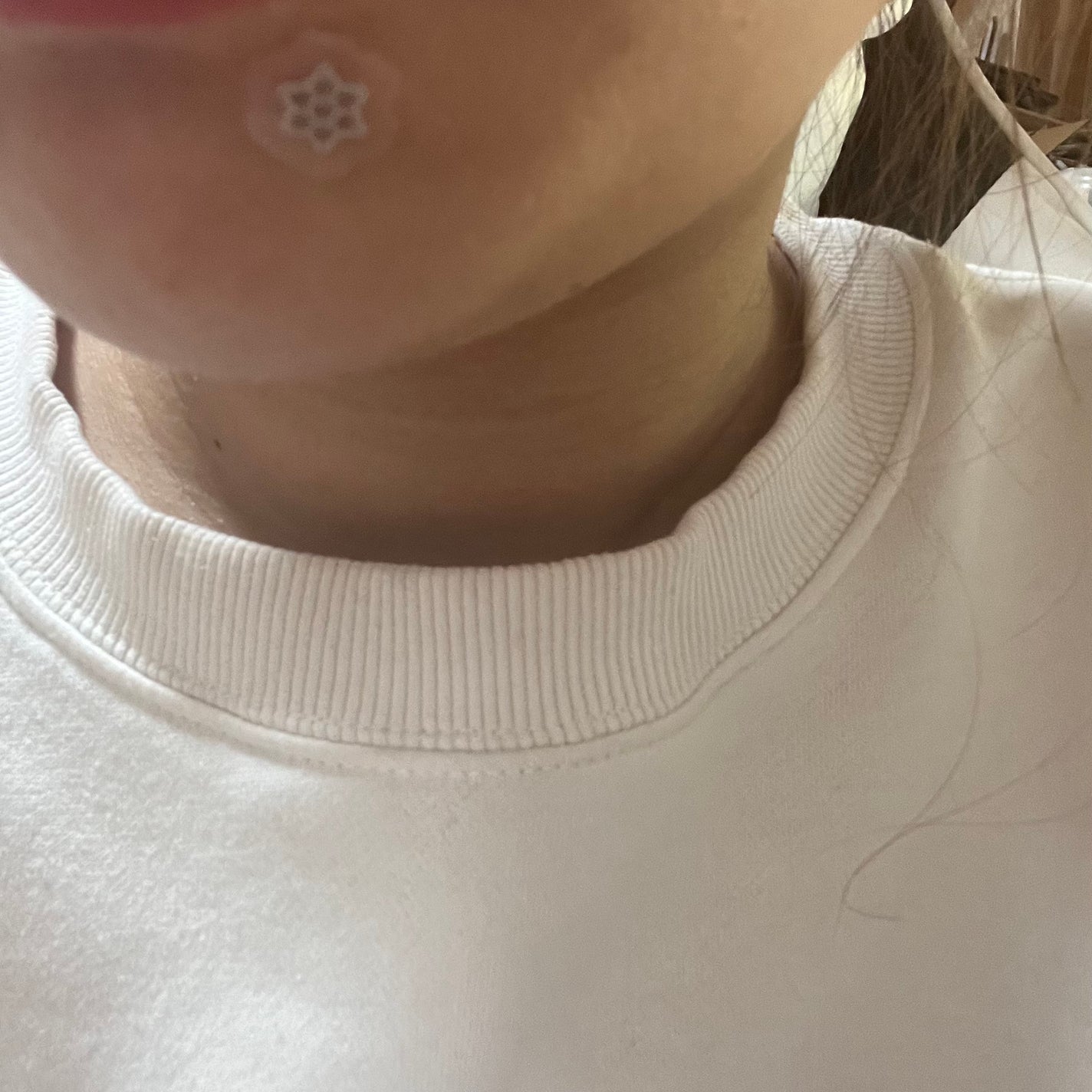 ACマグネシウムパッチ ミニ/スノーツープラス/にきびパッチを使ったクチコミ(5枚目)