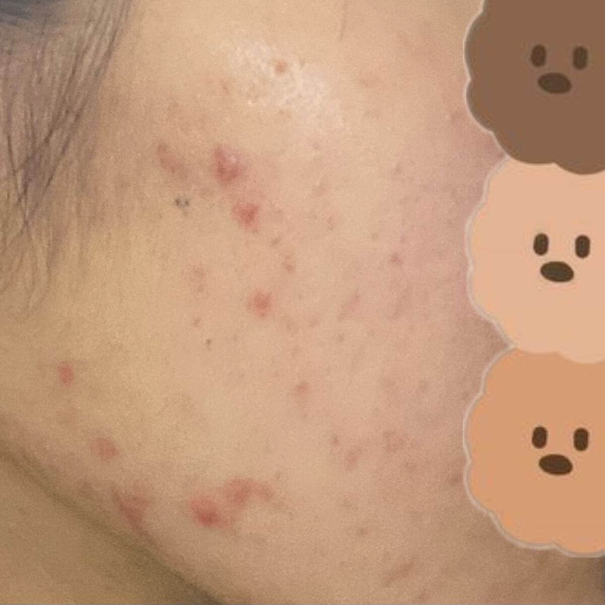 皮脂トラブルケア 保湿ジェル/キュレル/化粧水を使ったクチコミ（3枚目）