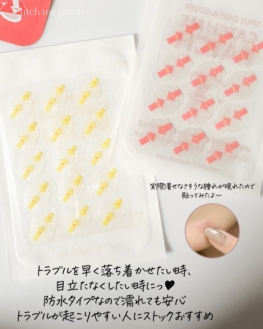 キャッチミーパッチ/CATCH ME PATCH/にきびパッチを使ったクチコミ(4枚目)