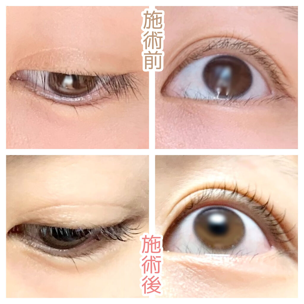 ラッシュアディクト アイラッシュコンディショニングセラム/soaddicted/まつげ美容液を使ったクチコミ（3枚目）