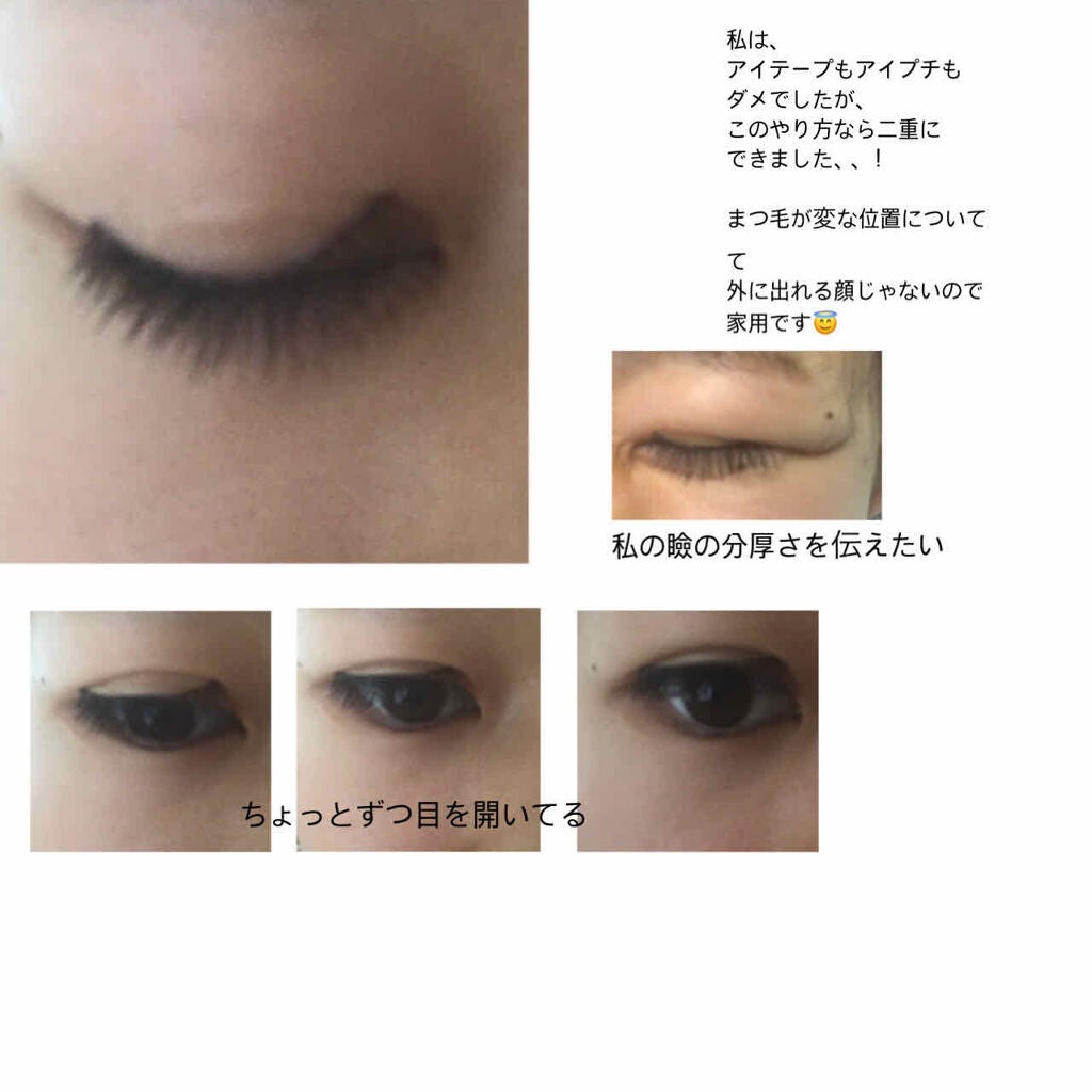 fresh_rouge_e1hu on LIPS 「めちゃくちゃ重い一重が、二重になった話幅広二重になりたいひと、..」(3枚目)