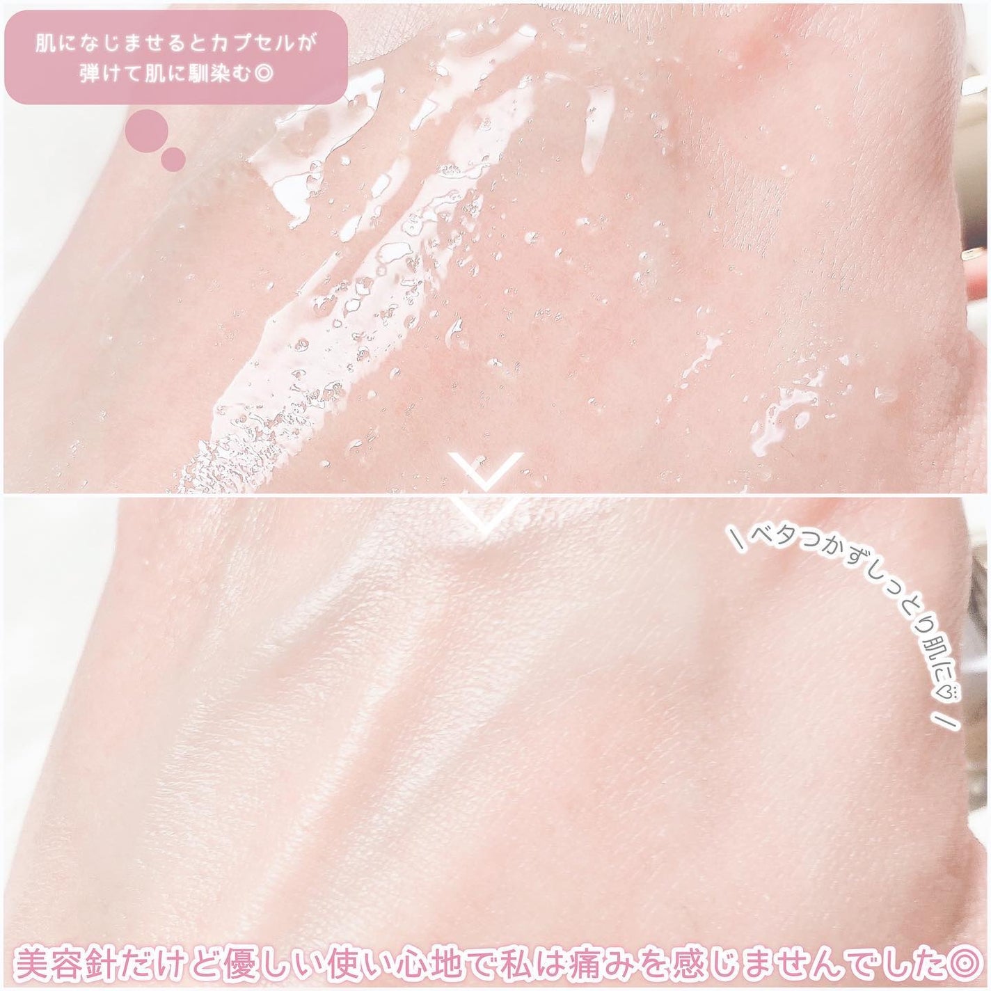 マイクロダーマブースター/XOUL/美容液を使ったクチコミ(4枚目)