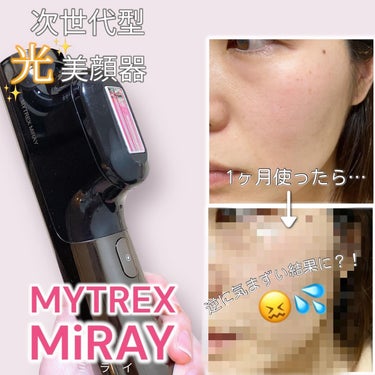 ムダ毛ケアもできる光美顔器、MYTREX MiRAYを1ヶ月間使ったら…？！

美肌ケアモードを週2回、1ヶ月間使ったよ！
「光」って言っても家庭用のパワーでしょ？となめてたら
割と変化出てびっくり😳
