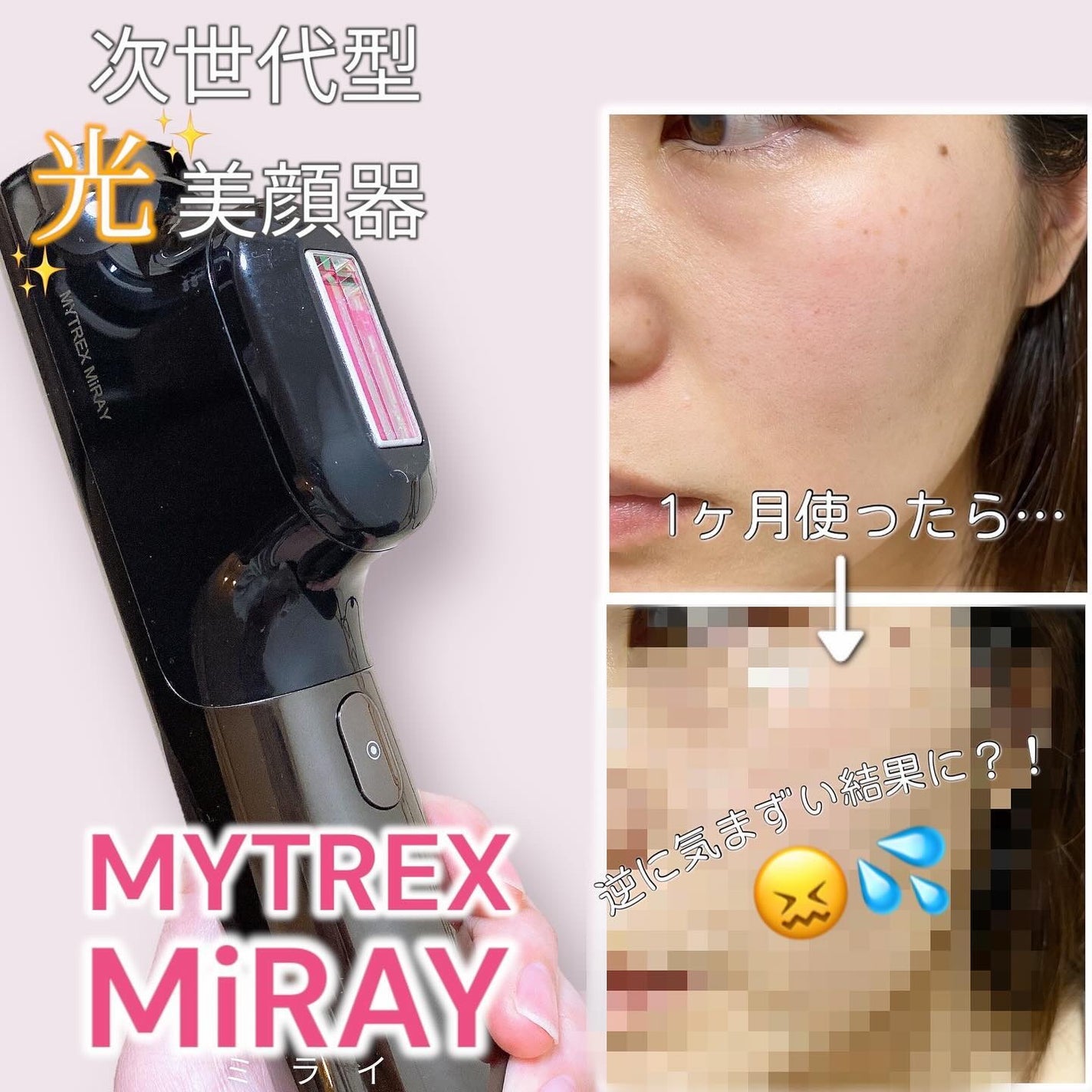 MiRAY|MYTREXの口コミ - ムダ毛ケアもできる光美顔器、MYTREX MiRAY|MYTREXの口コミ - ムダ毛ケアもできる光美顔器、MYTREX