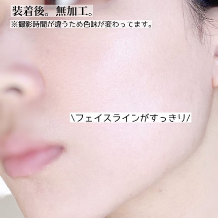 メディリフト /YA-MAN TOKYO JAPAN/美顔器・マッサージを使ったクチコミ(5枚目)