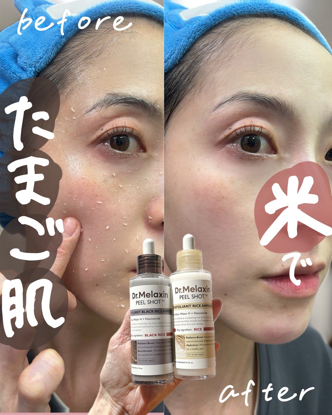 白米ピールショットゴマージュアンプル/Dr.Melaxin/美容液を使ったクチコミ(1枚目)