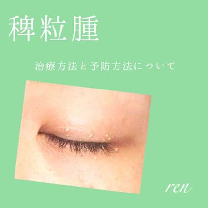 スキンケア洗顔料 スクラブin/ビオレ/洗顔フォームを使ったクチコミ(1枚目)