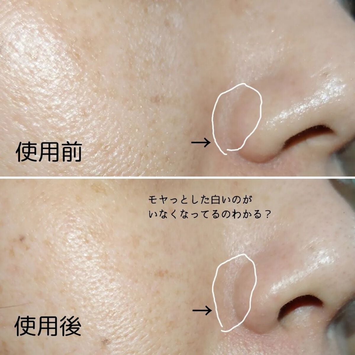 プレミアム小鼻ケア洗顔ブラシ/六角館さくら堂/その他スキンケアグッズを使ったクチコミ(5枚目)