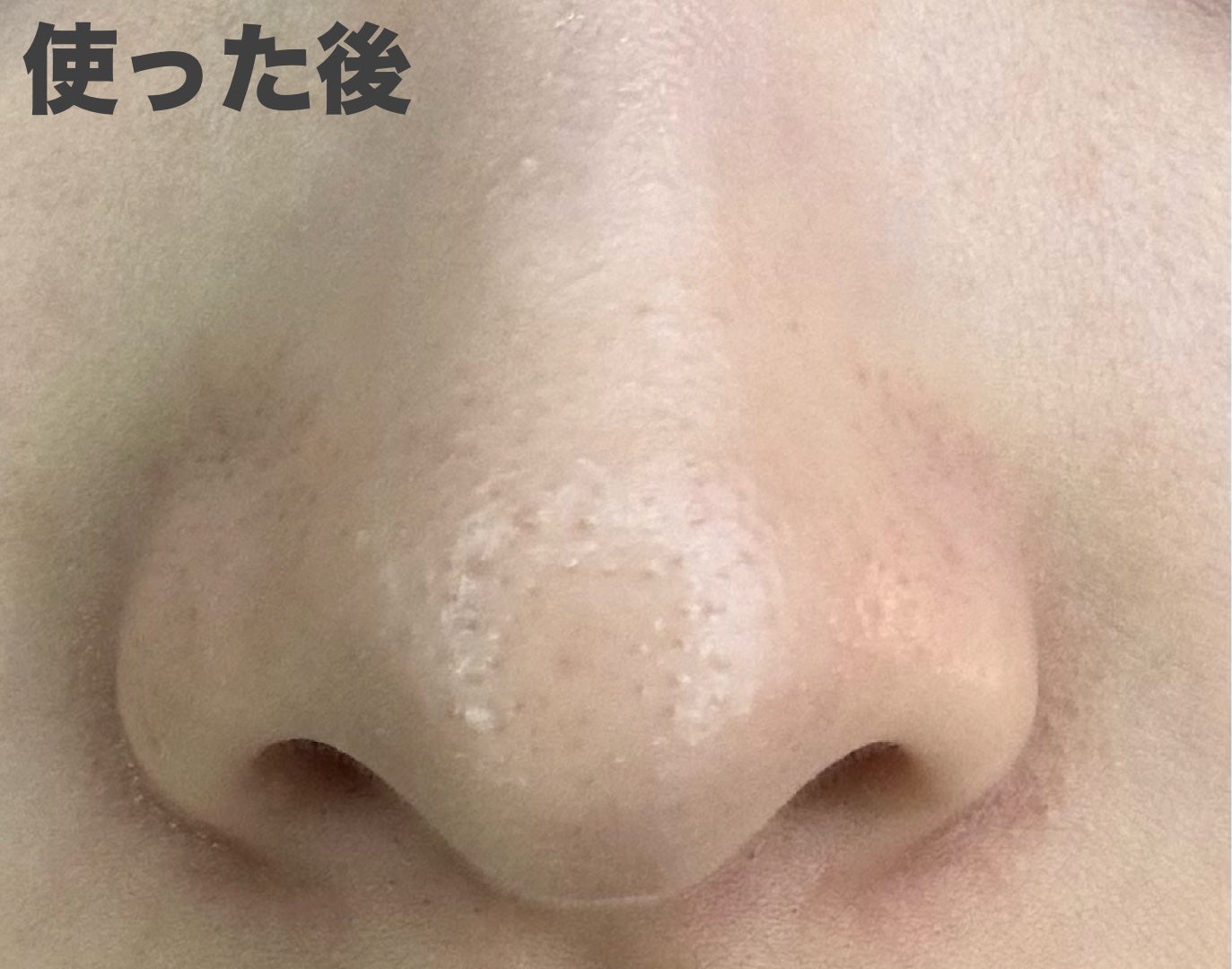 ノーズピーリングパック/One-day's you/シートマスク・パックを使ったクチコミ(3枚目)