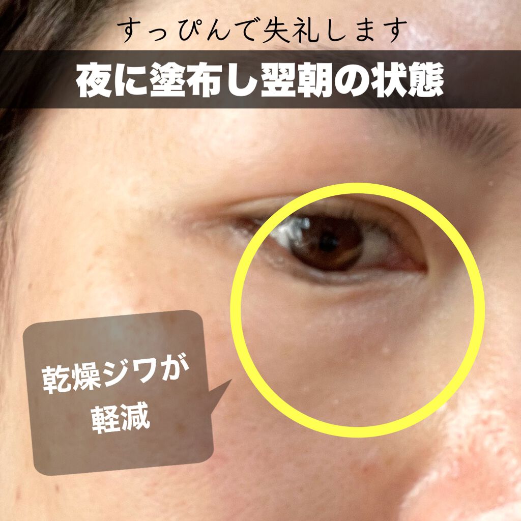 リンクルアイクリーム N/なめらか本舗/アイケア・アイクリームを使ったクチコミ(3枚目)