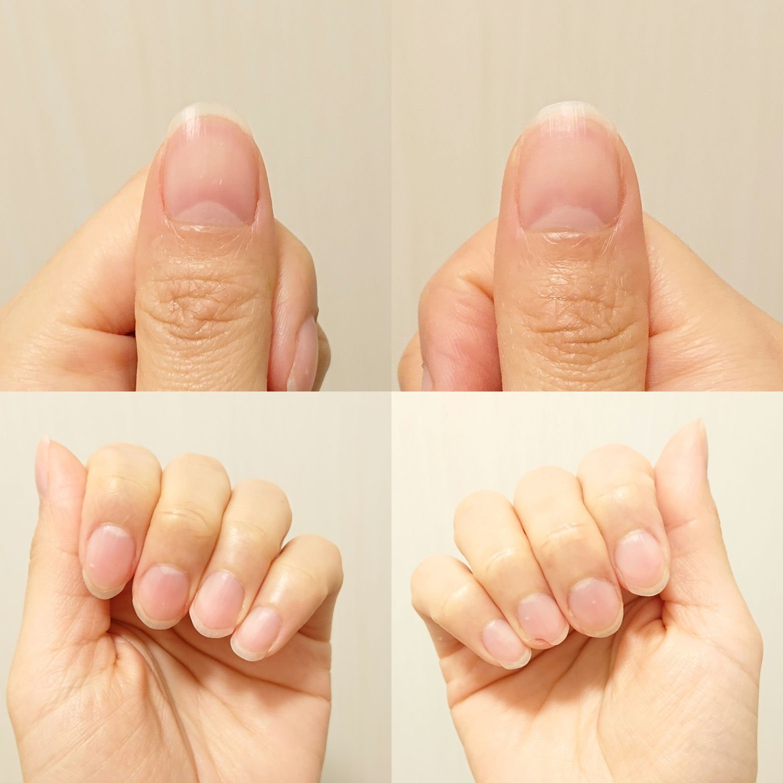 シア ネイルオイル 7.5ml【旧】/L'OCCITANE/ネイルオイル・トリートメントを使ったクチコミ（2枚目）