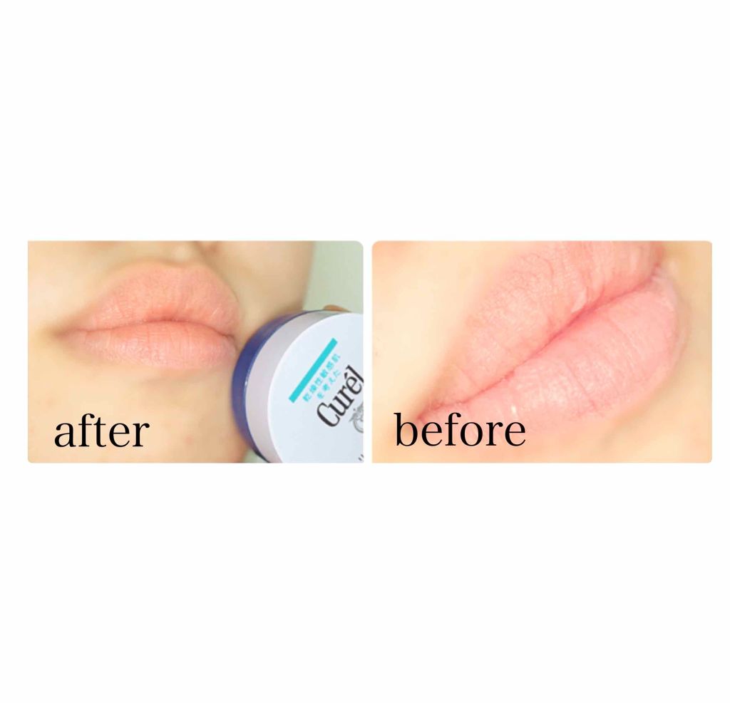 リップケア バーム/キュレル/リップバームを使ったクチコミ(3枚目)