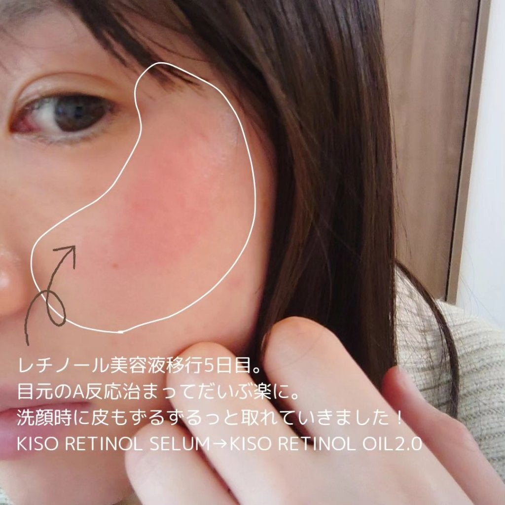 フェイスマスク 【しっかり実感30枚セット】/KISO/シートマスク・パックを使ったクチコミ(2枚目)