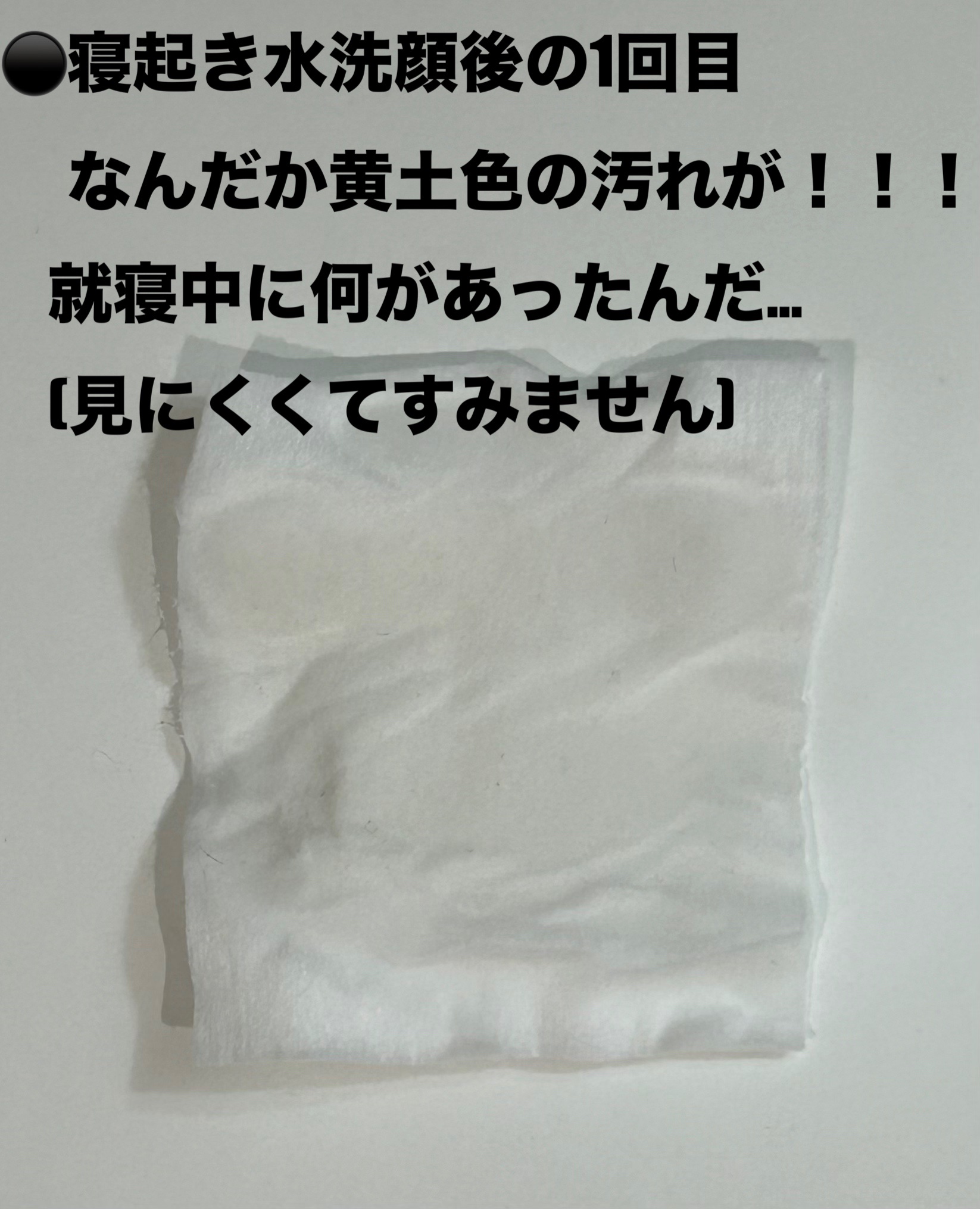 サンシビオ エイチツーオー D/ビオデルマ/クレンジングウォーターを使ったクチコミ（3枚目）