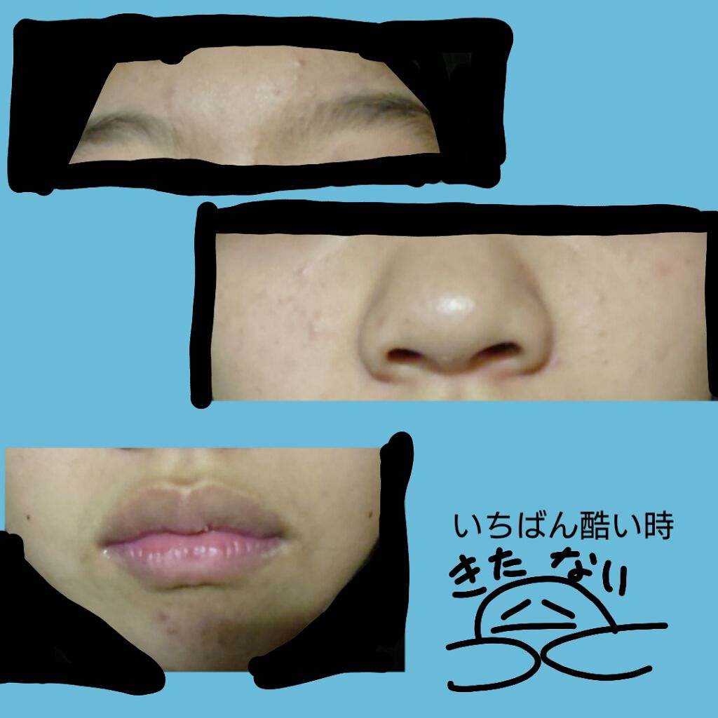 化粧水・敏感肌用・高保湿タイプ/無印良品/化粧水を使ったクチコミ(2枚目)