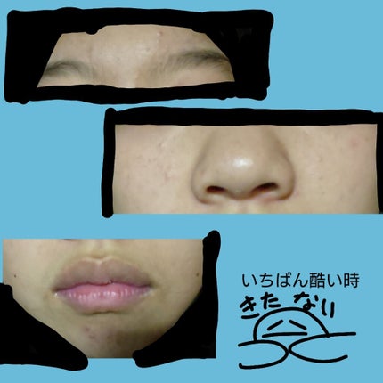 化粧水・敏感肌用・高保湿タイプ/無印良品/化粧水を使ったクチコミ(2枚目)