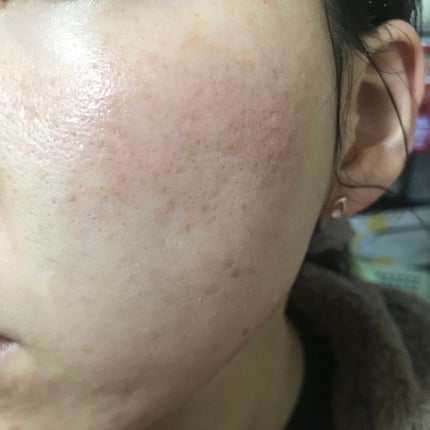 N10+Z1フェイスセラム /The Ordinary/美容液を使ったクチコミ(2枚目)