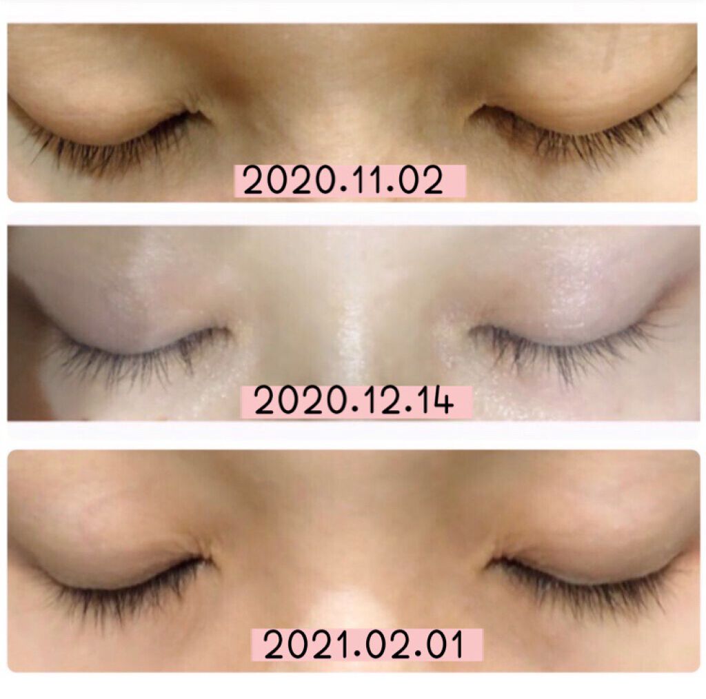 エグータム/アルマダスタイル/まつげ美容液を使ったクチコミ(2枚目)