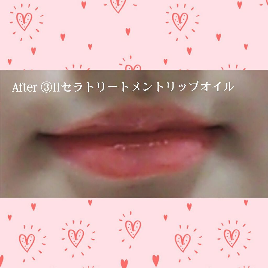 ウォーターリップ 無香料/メンソレータム/リップクリームを使ったクチコミ(4枚目)