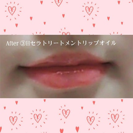 ウォーターリップ 無香料/メンソレータム/リップクリームを使ったクチコミ(4枚目)